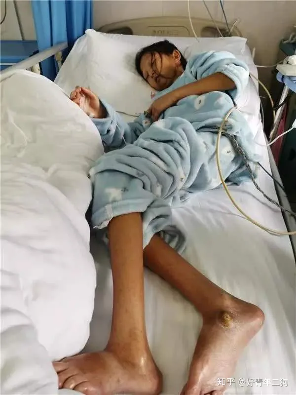 24岁，43斤，贵州女大学生吴花燕，死了！-贵州大学生吴花艳简历