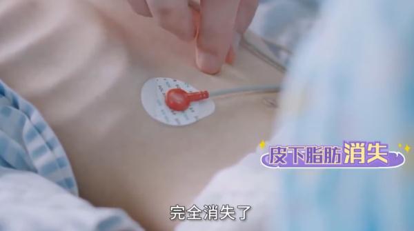 15岁少女减肥至24.8公斤去世，什么加剧了身材焦虑-东莞15岁女孩减肥