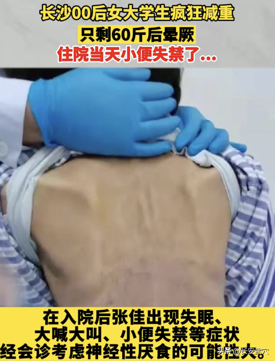1米65只有50斤？！那个为爱减肥的15岁少女走了-身高1.65米体重115斤胖吗