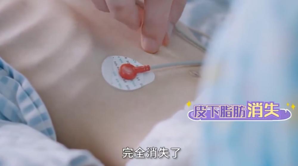 广东15岁女孩减肥至24.8公斤去世，节食求瘦之风为何蔓延中小学？-广东女子减肥长高