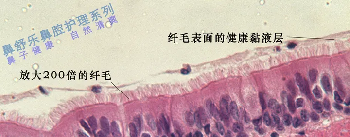 鼻窦炎如何根治？（儿童鼻窦炎的最明显五大症状）