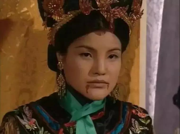 知名女艺人当街遭暴徒殴打！缝了11针！她的回应是...-明星被打要害