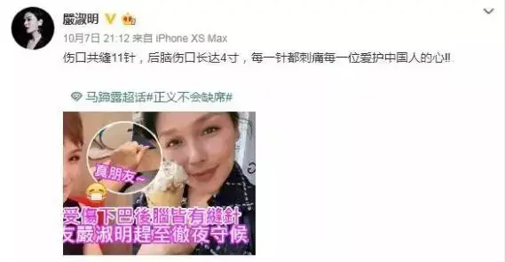 知名女艺人当街遭暴徒殴打！缝了11针！她的回应是...-明星被打要害