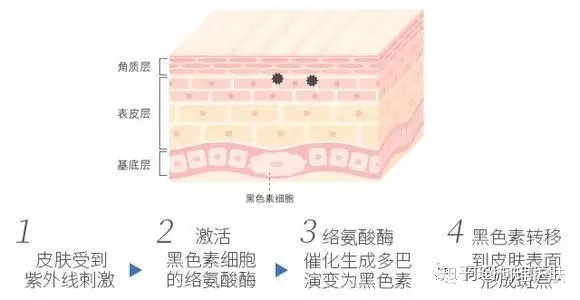 可见一“斑”，色斑及色沉的预防及治疗！-可见一斑为什么是斑点的斑?