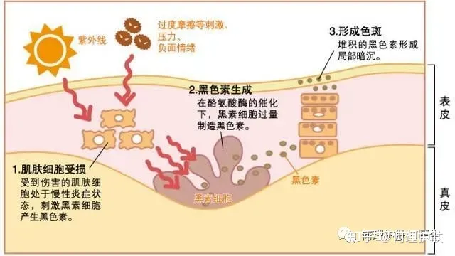 可见一“斑”，色斑及色沉的预防及治疗！-可见一斑为什么是斑点的斑?