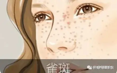可见一“斑”，色斑及色沉的预防及治疗！-可见一斑为什么是斑点的斑?