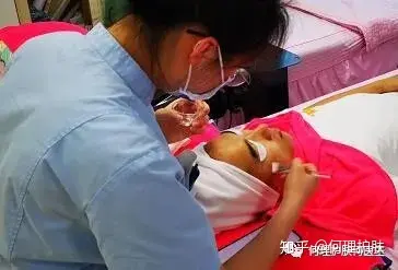 可见一“斑”，色斑及色沉的预防及治疗！-可见一斑为什么是斑点的斑?