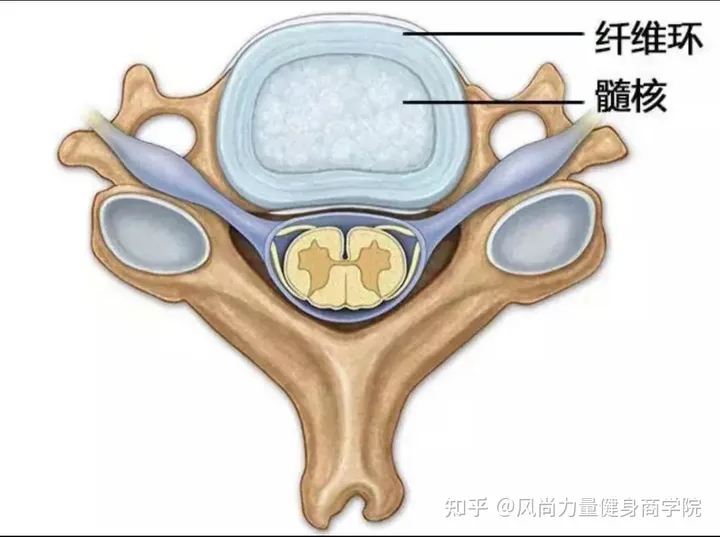 部队训练椎间盘突出解决方案-腰间盘突出军训会怎么样
