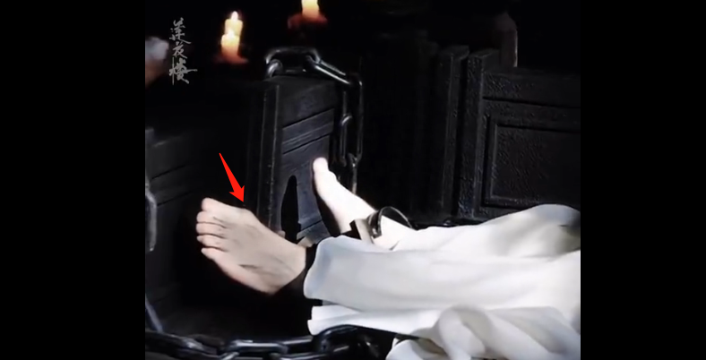 成毅缺陷曝光，拇指外翻遗传，团队撇清关系，网友建议就医治疗-成毅脸歪