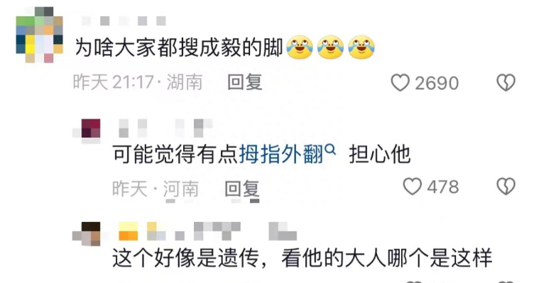成毅缺陷曝光，拇指外翻遗传，团队撇清关系，网友建议就医治疗-成毅脸歪