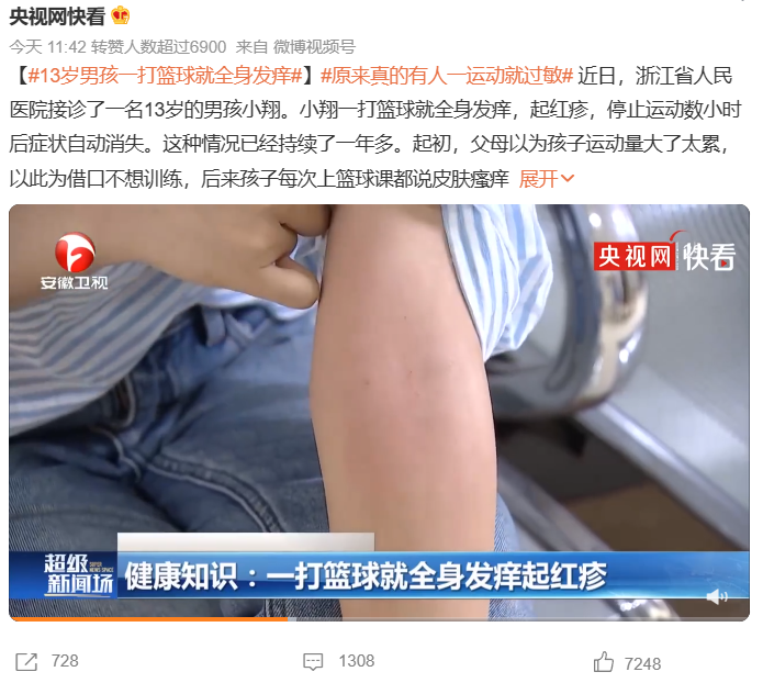 上热搜！原来真的有人一运动就过敏！就算躺平这病也得治 →-一运动就过敏怎么办