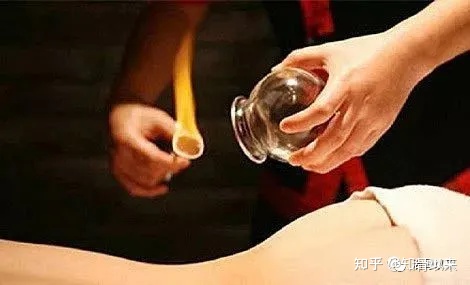 腰椎间盘突出症的治疗方法（完整版）-腰椎间盘突出症的治疗方式