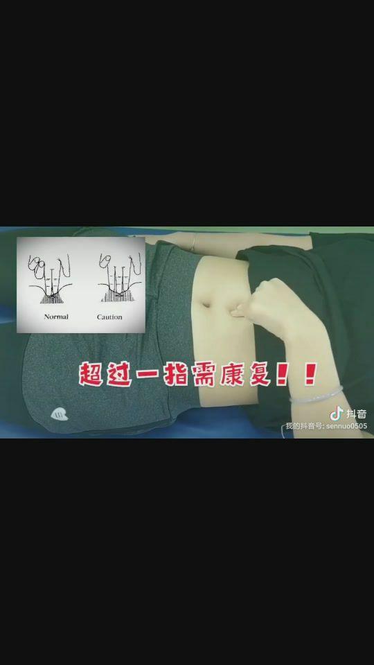 产后应该怎么修复，有哪些内容？-产后修复的最佳方法