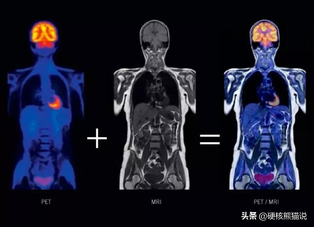 中国医学设备崛起：影像芯片突破垄断，国产化替代还远吗？-医学影像设备公司排名